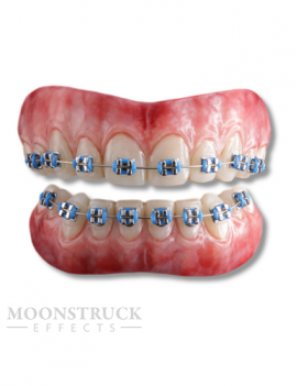Moonstruck Effects Anwen ProFX Teeth With Blue Braces