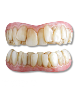 Moonstruck Effects Grinch ProFX Teeth